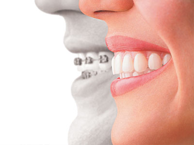 Glowing Smile Dental Studio | Laser Dentistry, Ceramic Crowns and Oral Exams