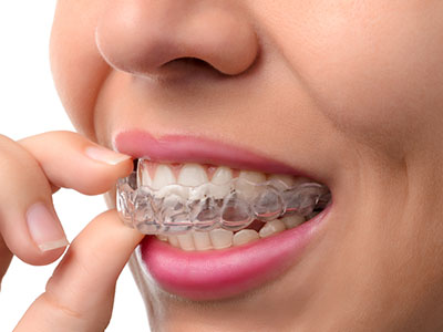 Glowing Smile Dental Studio | Ceramic Crowns, Dentures and Cosmetic Dentistry