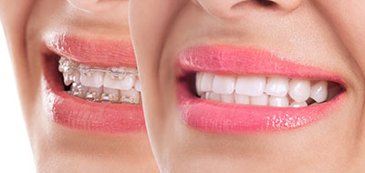 Glowing Smile Dental Studio | Laser Dentistry, Cosmetic Dentistry and Pediatric Dentistry