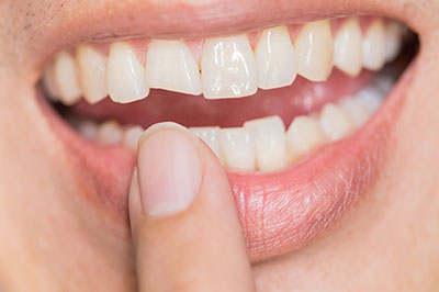 Glowing Smile Dental Studio | Invisalign reg , Oral Exams and Night Guards