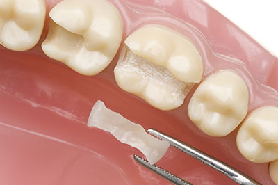 Glowing Smile Dental Studio | Ceramic Crowns, Invisalign reg  and Pediatric Dentistry