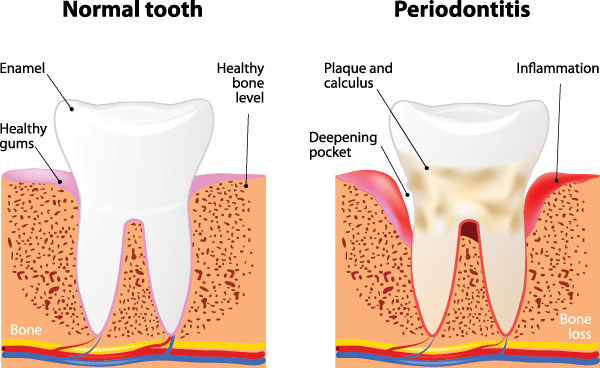 Glowing Smile Dental Studio | Implant Dentistry, Veneers and Ceramic Crowns