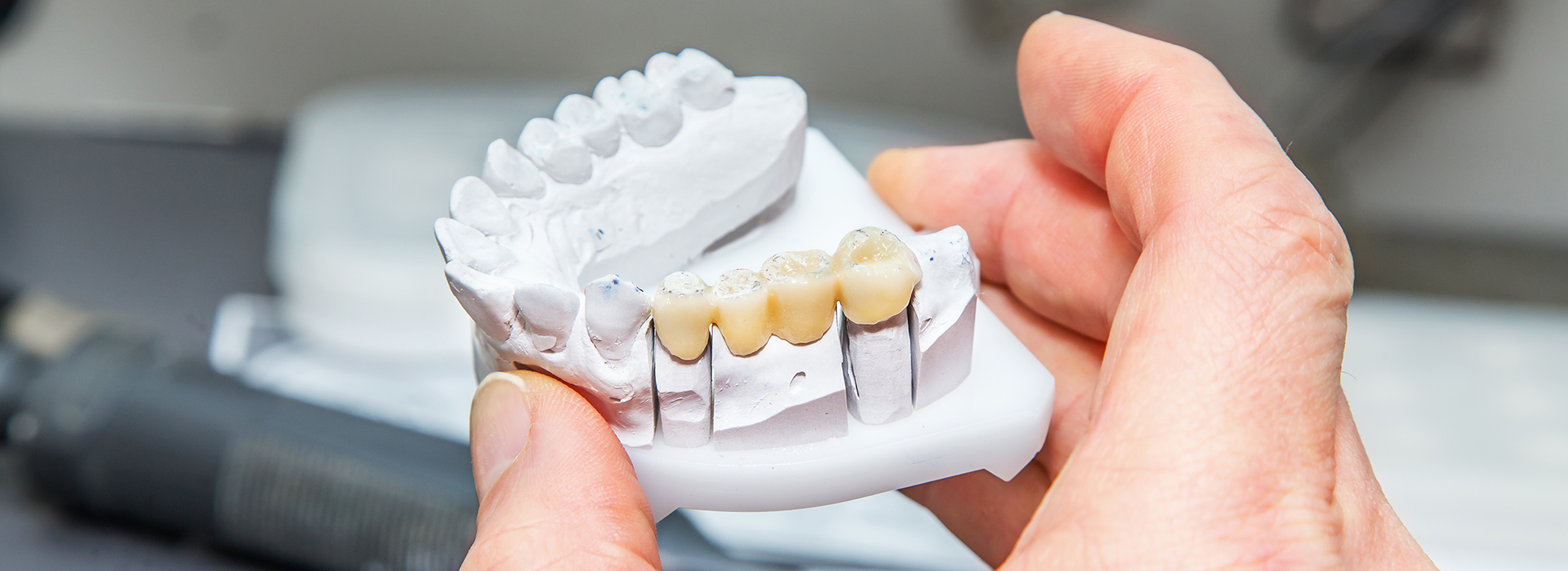 Glowing Smile Dental Studio | Dental Cleanings, Preventative Program and Dentures