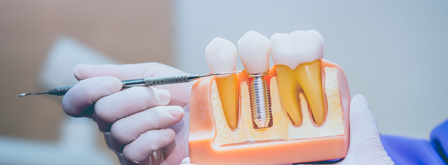 Glowing Smile Dental Studio | Implant Restorations, Preventative Program and Dental Bridges